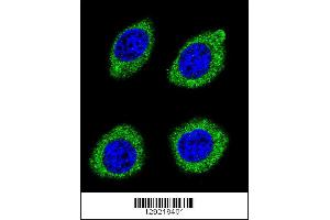 Confocal immunofluorescent analysis of HSD11B1L Antibody with U-251MG cell followed by Alexa Fluor 488-conjugated goat anti-rabbit lgG (green). (HSD11B1L anticorps  (C-Term))