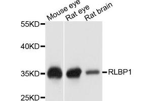 Western blot analysis of extract of various cells, using RLBP1 antibody. (RLBP1 anticorps)