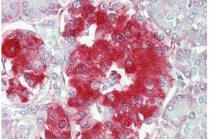 Human Pancreas: Formalin-Fixed, Paraffin-Embedded (FFPE)