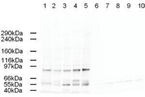 Image no. 1 for anti-Adaptor-Related Protein Complex 2, alpha 2 Subunit (AP2A2) (AA 3-14) antibody (ABIN401165)
