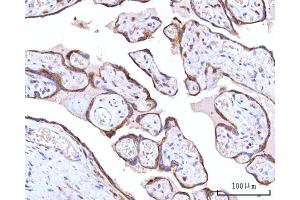 IHC analysis of RPN1 using anti-RPN1 antibody (ABIN7600447). (RPN1 anticorps  (AA 196-495))