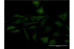 Immunofluorescence of monoclonal antibody to SFN on HeLa cell. (14-3-3 sigma/SFN anticorps  (AA 1-248))