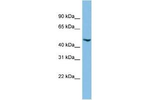 WB Suggested Anti-C17orf75 Antibody Titration: 0. (C17orf75 anticorps  (Middle Region))