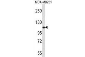 Western Blotting (WB) image for anti-Actinin, alpha 3 (ACTN3) antibody (ABIN2996665)