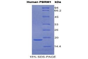 SDS-PAGE (SDS) image for Polybromo 1 (PBRM1) (AA 1152-1273) protein (His tag) (ABIN1877691)