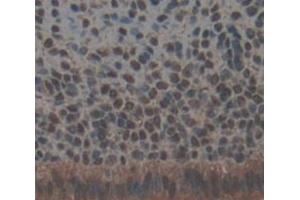 Used in DAB staining on fromalin fixed paraffin- embedded Kidney tissue (TRRAP anticorps  (AA 3534-3770))