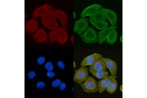 ABIN6260056 and ABIN6272251 staining Hela cells(30 min of UV treatment) by IF/ICC. (ARRDC4 anticorps  (Internal Region))
