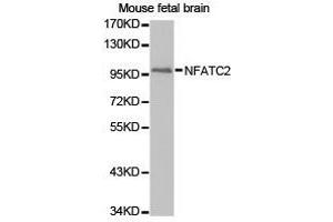 Western Blotting (WB) image for anti-Nuclear Factor of Activated T-Cells, Cytoplasmic, Calcineurin-Dependent 2 (NFAT1) antibody (ABIN1873890) (NFAT1 anticorps)