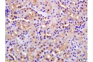 Formalin-fixed and paraffin embedded rat kidney labeled with Anti-CAP1/PARK7 Polyclonal Antibody, Unconjugated (ABIN674739) at 1:200 followed by conjugation to the secondary antibody and DAB staining.