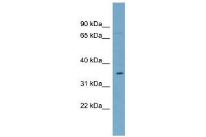 SLC39A2 antibody used at 1 ug/ml to detect target protein. (ZIP2 anticorps)