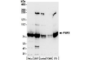 Western Blotting (WB) image for anti-Fragile X Mental Retardation 1 (FMR1) (AA 600-650) antibody (ABIN7450256)
