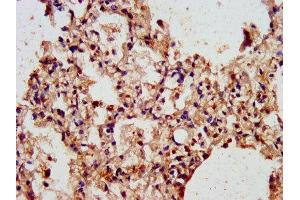 IHC image of ABIN7143473 diluted at 1:300 and staining in paraffin-embedded human lung tissue performed on a Leica BondTM system. (ARL1 anticorps  (AA 2-181))