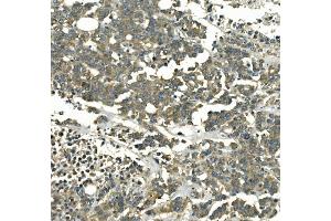 IHC analysis of Galectin 2/LGALS2 using anti-Galectin 2/LGALS2 antibody (ABIN7598979). (Galectin 2 anticorps  (AA 1-132))