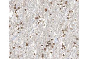 ABIN6266630 at 1/100 staining human brain tissue sections by IHC-P.