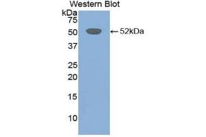 Detection of Recombinant FGb, Mouse using Polyclonal Antibody to Fibrinogen Beta Chain (FGB) (Fibrinogen beta Chain anticorps  (AA 35-481))