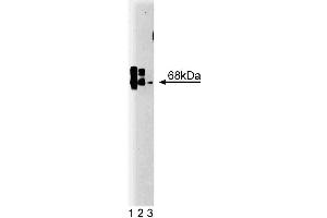 Western blot analysis of CaM Kinase Kinase on rat brain lysate. (CaM Kinase Kinase (AA 341-504) anticorps)