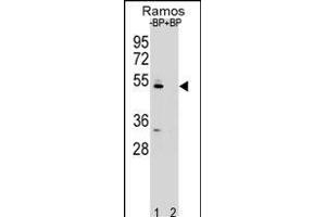 Western blot analysis of ZDHC2 Antibody (N-term) Pab (ABIN651781 and ABIN2840397) pre-incubated without(lane 1) and with(lane 2) blocking peptide in Ramos cell line lysate.