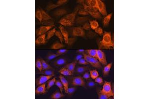 Immunofluorescence analysis of U-2 OS cells using F Rabbit mAb (ABIN7267150) at dilution of 1:100 (40x lens). (FABP1 anticorps)