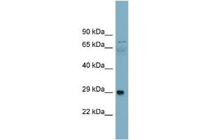 WB Suggested Anti-Alpha-DAG1 Antibody Titration:  0. (Dystroglycan anticorps  (Middle Region))