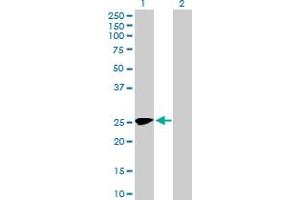 Western Blot analysis of MMACHC expression in transfected 293T cell line by MMACHC MaxPab polyclonal antibody.
