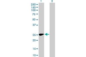Western Blot analysis of MMACHC expression in transfected 293T cell line by MMACHC MaxPab polyclonal antibody. (MMACHC anticorps  (AA 1-225))