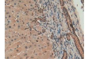 Detection of ANXA4 in Human Liver Tissue using Polyclonal Antibody to Annexin A4 (ANXA4)