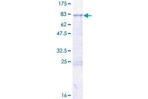 Image no. 1 for GTP Binding Protein 6 (Putative) (GTPBP6) (AA 1-403) protein (GST tag) (ABIN1306191)