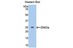 Western Blotting (WB) image for anti-Aminopeptidase Puromycin Sensitive (NPEPPS) (AA 584-793) antibody (ABIN1176245)
