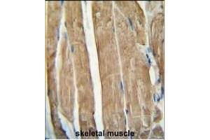 PG antibody (N-term) (ABIN654461 and ABIN2844194) immunohistochemistry analysis in formalin fixed and paraffin embedded human skeletal muscle followed by peroxidase conjugation of the secondary antibody and DAB staining.