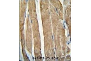 PG antibody (N-term) (ABIN654461 and ABIN2844194) immunohistochemistry analysis in formalin fixed and paraffin embedded human skeletal muscle followed by peroxidase conjugation of the secondary antibody and DAB staining.