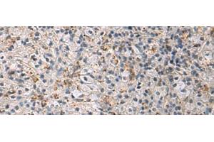 Immunohistochemistry of paraffin-embedded Human brain tissue using IRS4 Polyclonal Antibody at dilution of 1:45(x200) (IRS4 anticorps)