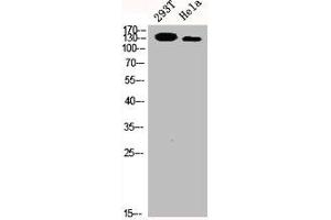 Western Blot analysis of 293T HELA cells using p140Cap Polyclonal Antibody (SRCIN1 anticorps  (Internal Region))