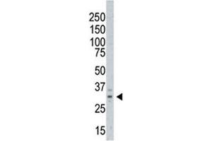 Western blot testing of AURKC antibody and A375 cell lysate.