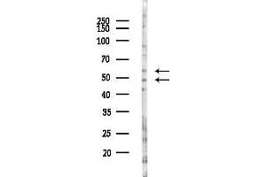 Western blot analysis of lysates from Hela cells(heat-shock,45 min treatment), using GPRC5C Antibody at 1/1000 dilution.