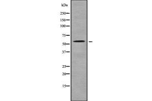 Western blot analysis SLC22A17 using K562 whole cell lysates (SLC22A17 anticorps  (C-Term))
