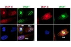 Image no. 2 for anti-Centromere Protein Q (CENPQ) antibody (ABIN1100754) (CENPQ anticorps)