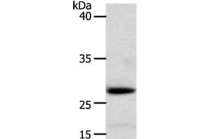 Western Blot analysis of Human liver cancer tissue using RARRES1 Polyclonal Antibody at dilution of 1:300 (RARRES1 anticorps)