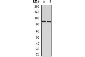 Western blot analysis of H6PD expression in mouse liver (A), mouse kidney (B) whole cell lysates. (Glucose-6-Phosphate Dehydrogenase anticorps)
