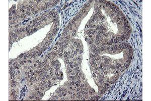 Image no. 1 for anti-Docking Protein 7 (DOK7) antibody (ABIN1497883)