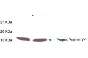 Western Blot Analysis of Prepro-Peptide YY in rat intestine tissue by Rabbit Anti-PYY(3-36)  (Human) Antibody.