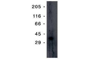 Image no. 1 for anti-Tumor Protein P53 Inducible Protein 3 (TP53I3) antibody (ABIN201596)