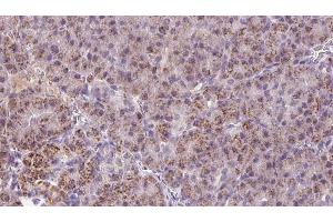 anti-HBS1-Like (HBS1L) (N-Term) antibody