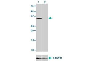 Western blot analysis of EIF2S1 over-expressed 293 cell line, cotransfected with EIF2S1 Validated Chimera RNAi (Lane 2) or non-transfected control (Lane 1).