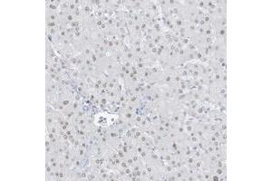 Immunohistochemical staining of human liver with ZFP64 polyclonal antibody  shows nuclear positivity in hepatocytes at 1:200-1:500 dilution. (ZFP64 anticorps)