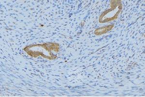 ABIN6268669 at 1/100 staining Human uterus tissue by IHC-P. (IL-5 anticorps  (Internal Region))