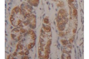 Detection of CK18 in Human Stomach Tissue using Polyclonal Antibody to Cytokeratin 18 (CK18) (Cytokeratin 18 anticorps  (AA 238-396))