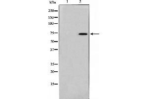 Western blot analysis on 293 cell lysate using TAF6L Antibody，The lane on the left is treated with the antigen-specific peptide. (TAF6L anticorps  (N-Term))