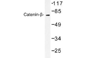 Image no. 1 for anti-Catenin (Cadherin-Associated Protein), beta 1, 88kDa (CTNNB1) antibody (ABIN272110) (CTNNB1 anticorps)