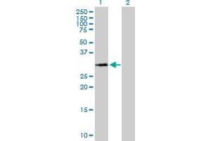 Western Blot analysis of HIST1H1A expression in transfected 293T cell line by HIST1H1A MaxPab polyclonal antibody. (Histone H1.1 anticorps  (AA 1-215))