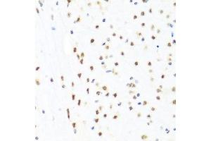 Immunohistochemistry of paraffin-embedded mouse brain using GATA2 antibody. (GATA2 anticorps  (AA 1-300))